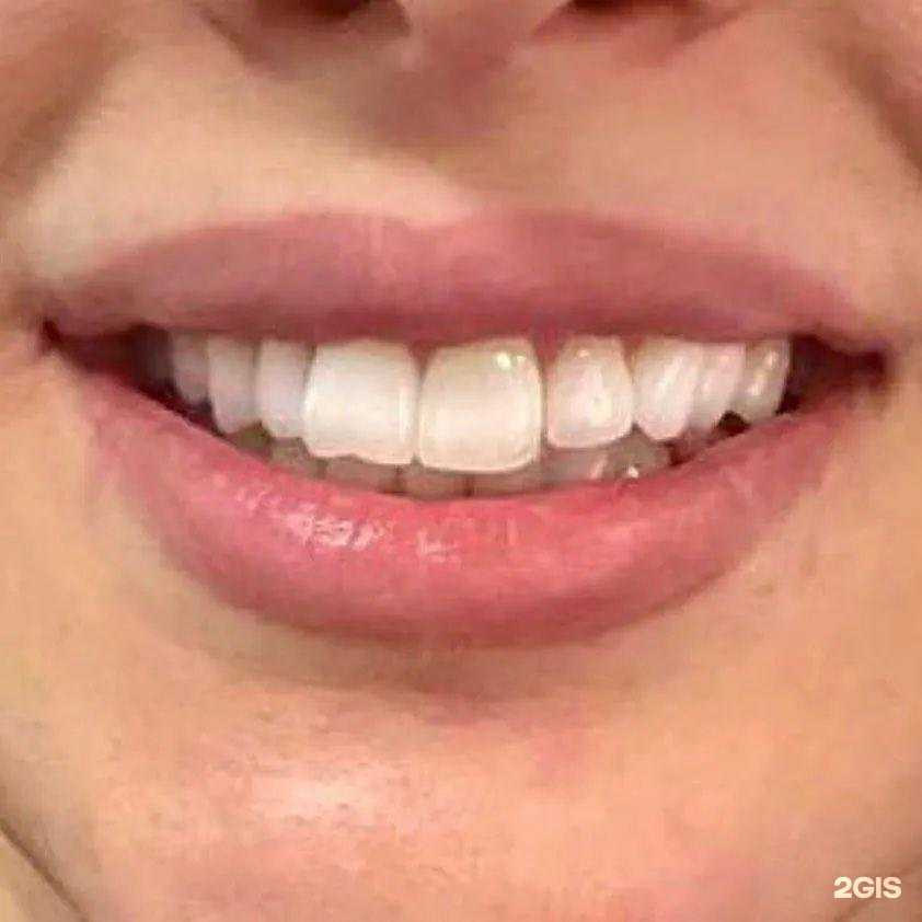 Отзывы на компанию Dental Studio в г. Грозный c фото