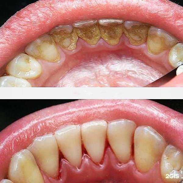 Отзывы на компанию Стека-Дент в г. Пенза c фото