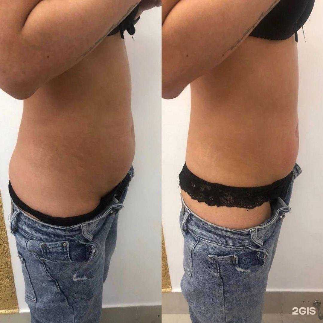 Отзывы на компанию Beauty&Health в Ульяновске c фото