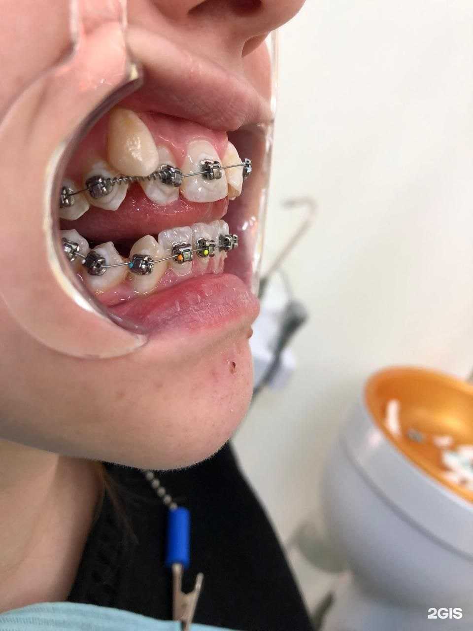 Отзывы на компанию Дента Лайф в Стерлитамаке c фото