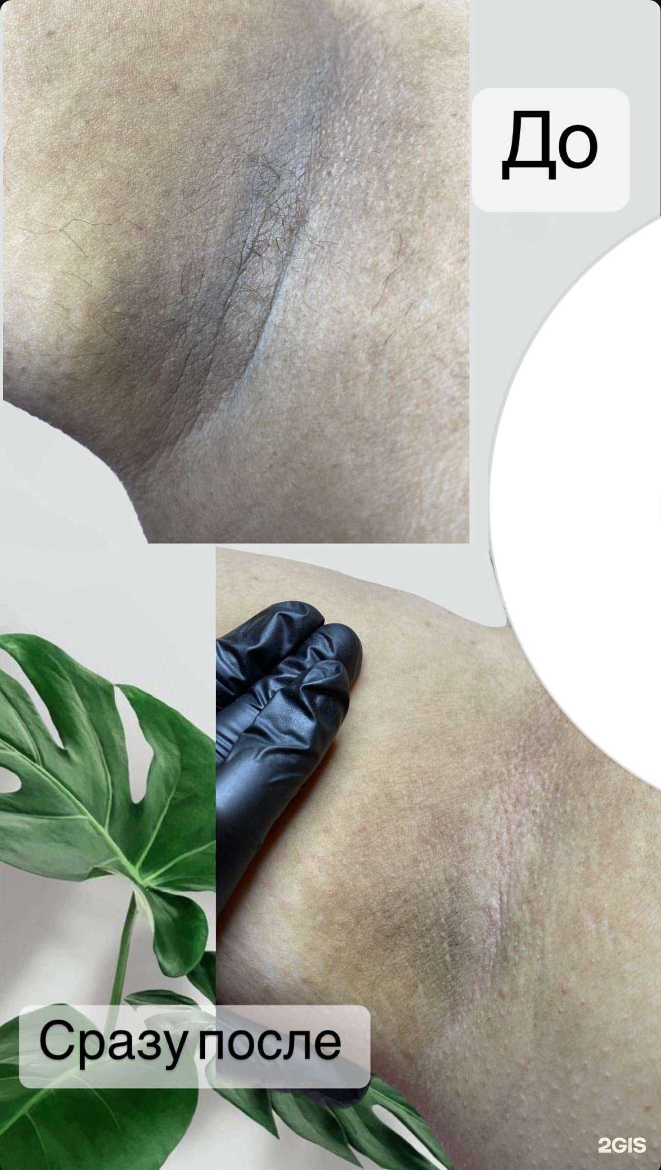 Отзывы на компанию Zebra_epil в Сочи c фото