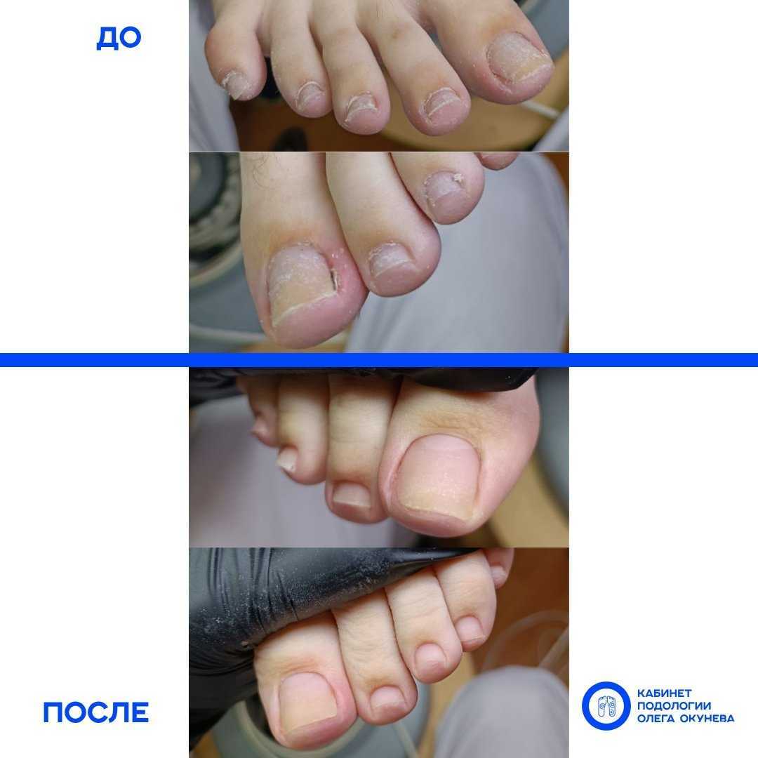 Отзывы на компанию Кабинет Подологии Олега Окунева в Иванове c фото