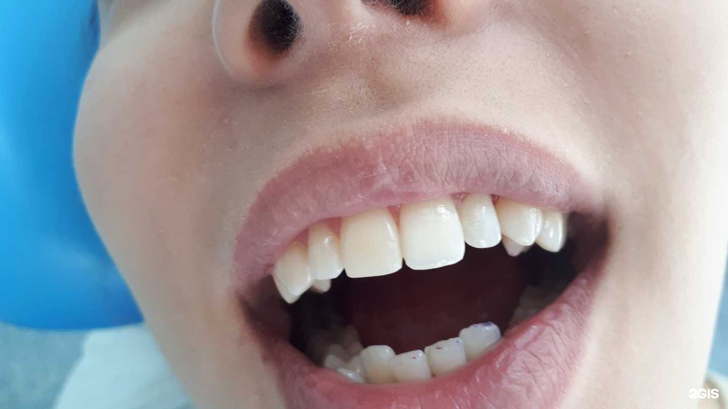 Отзывы на компанию Qdent в Сызрани c фото