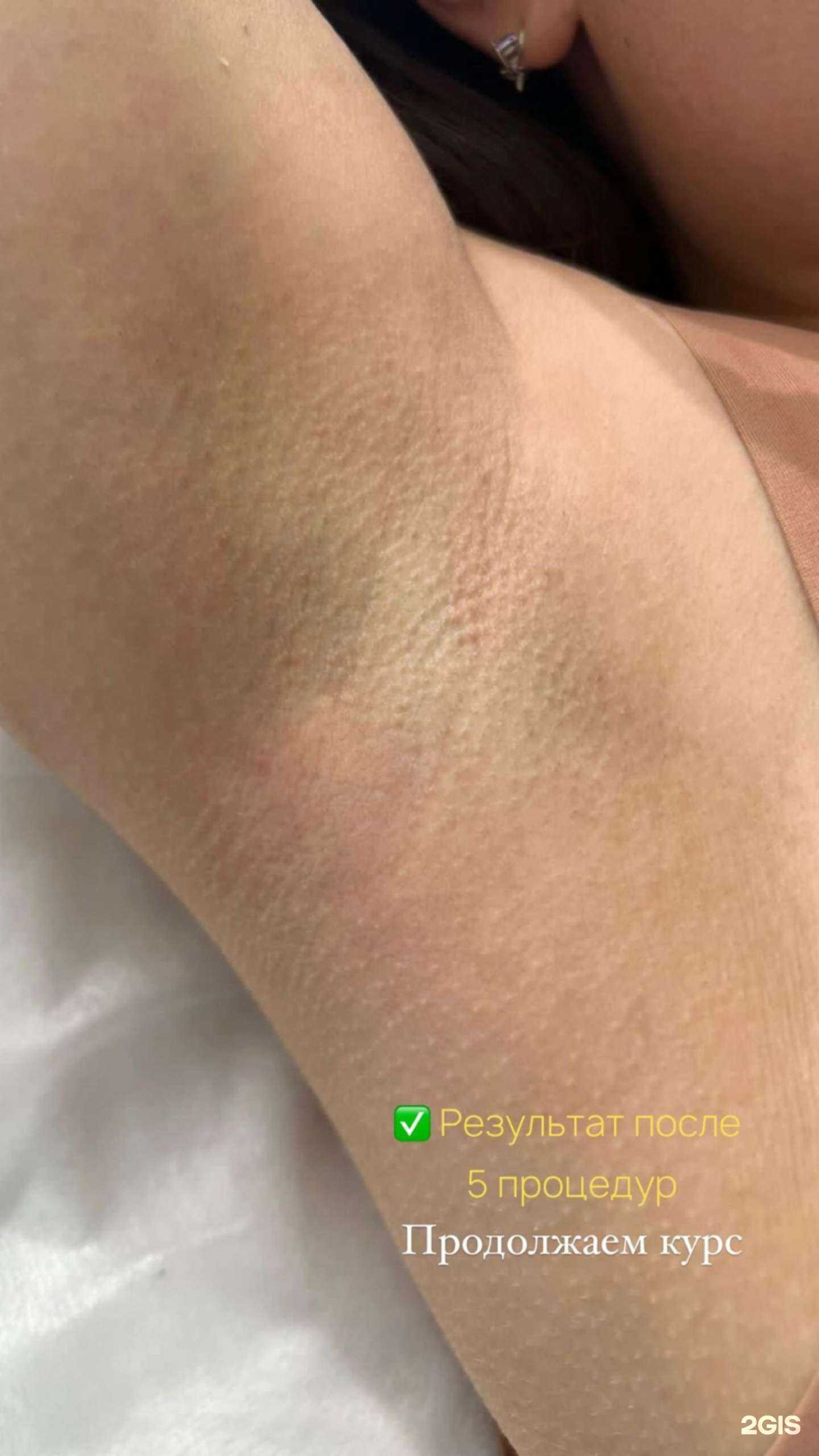 Отзывы на компанию Laser med в Сарове c фото