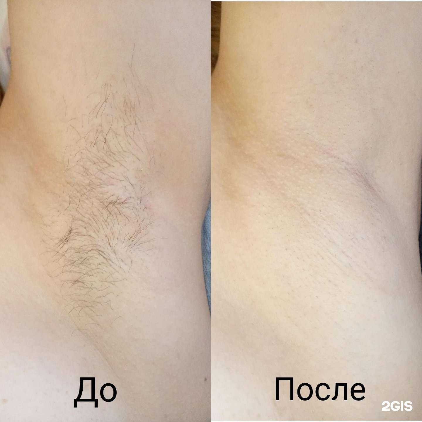 Отзывы на компанию Студия депиляции в Улан-Удэ c фото