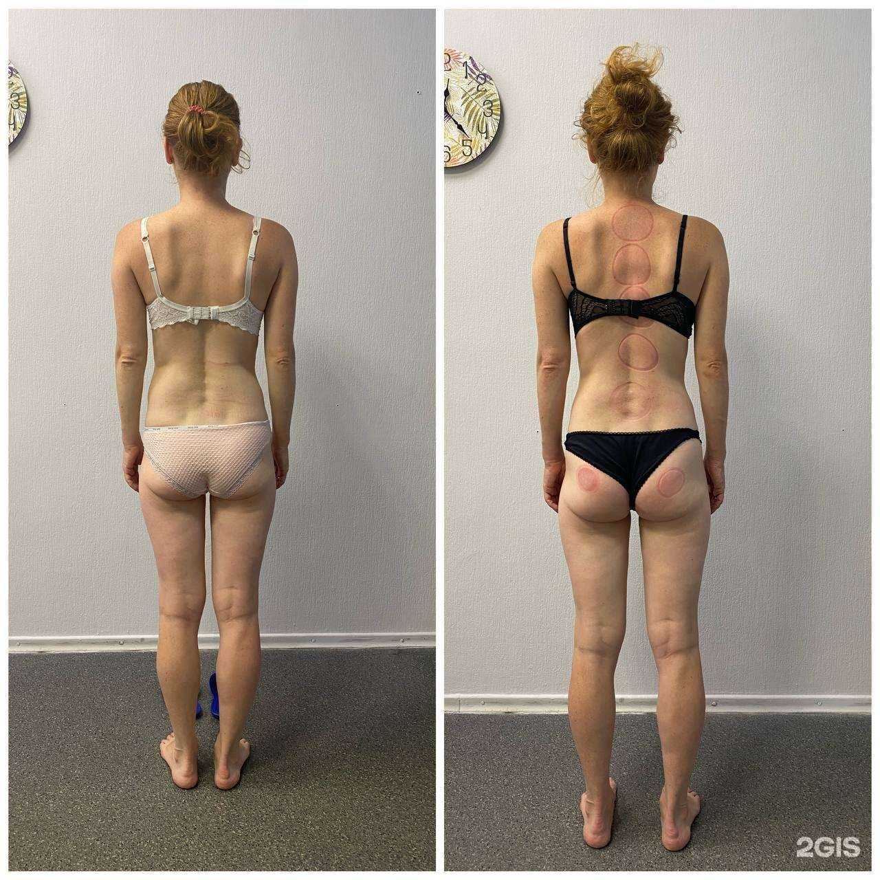 Отзывы на компанию Студия эпиляции и массажа в Воронеже c фото