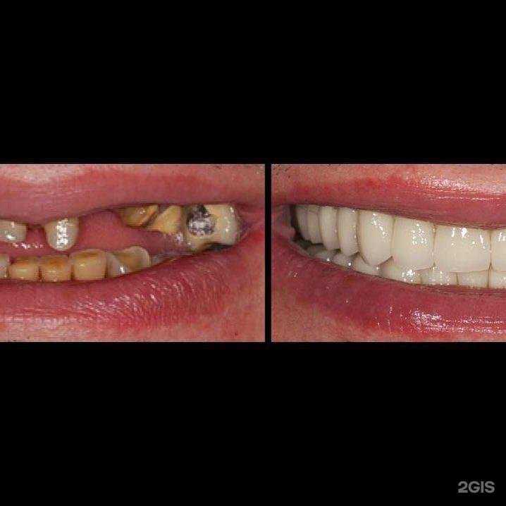 Отзывы на компанию Vita-Стом в г. Махачкала c фото