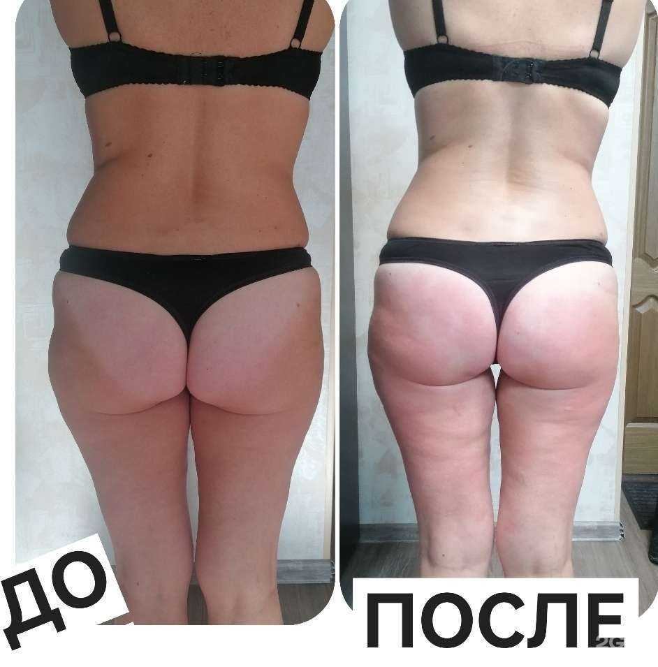 Отзывы на компанию Студия эпиляции и коррекции фигуры в Омске c фото