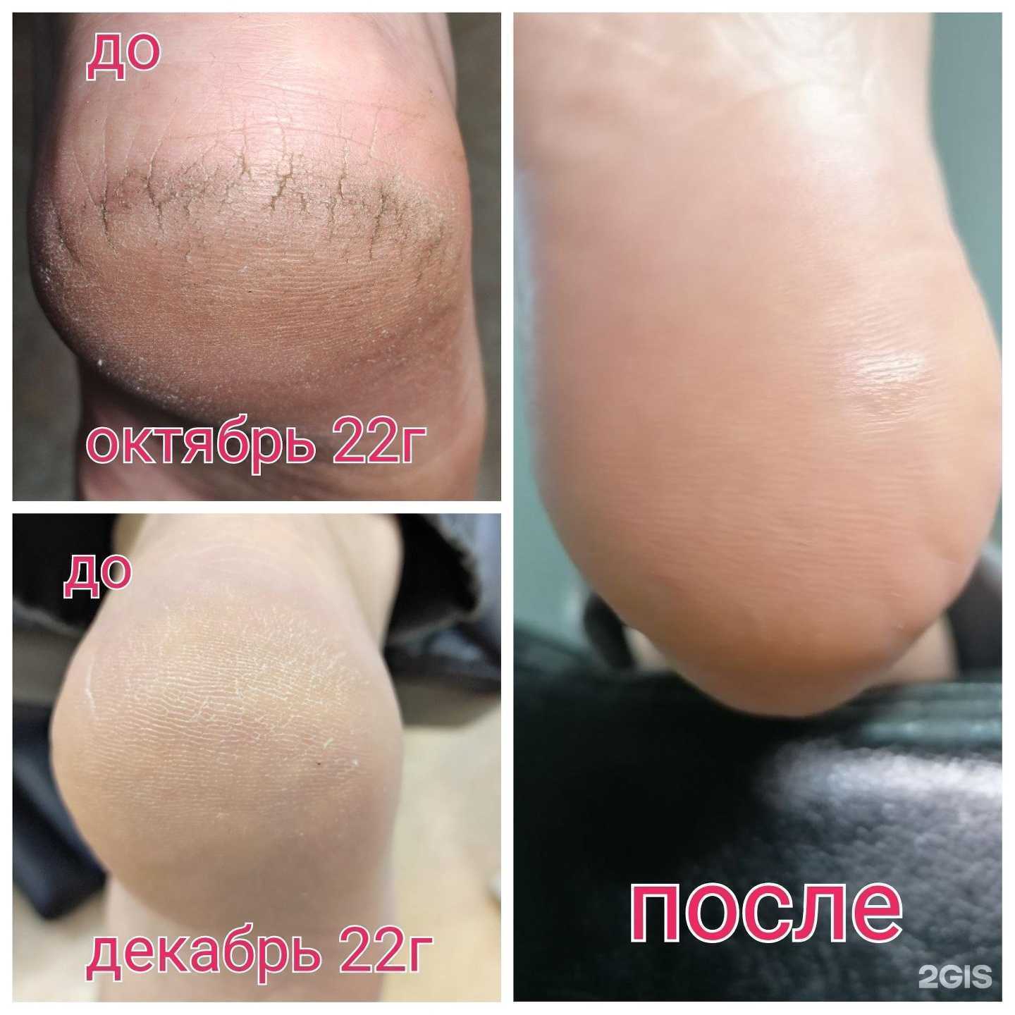 Отзывы на компанию PodoExpert_58 в г. Пенза c фото