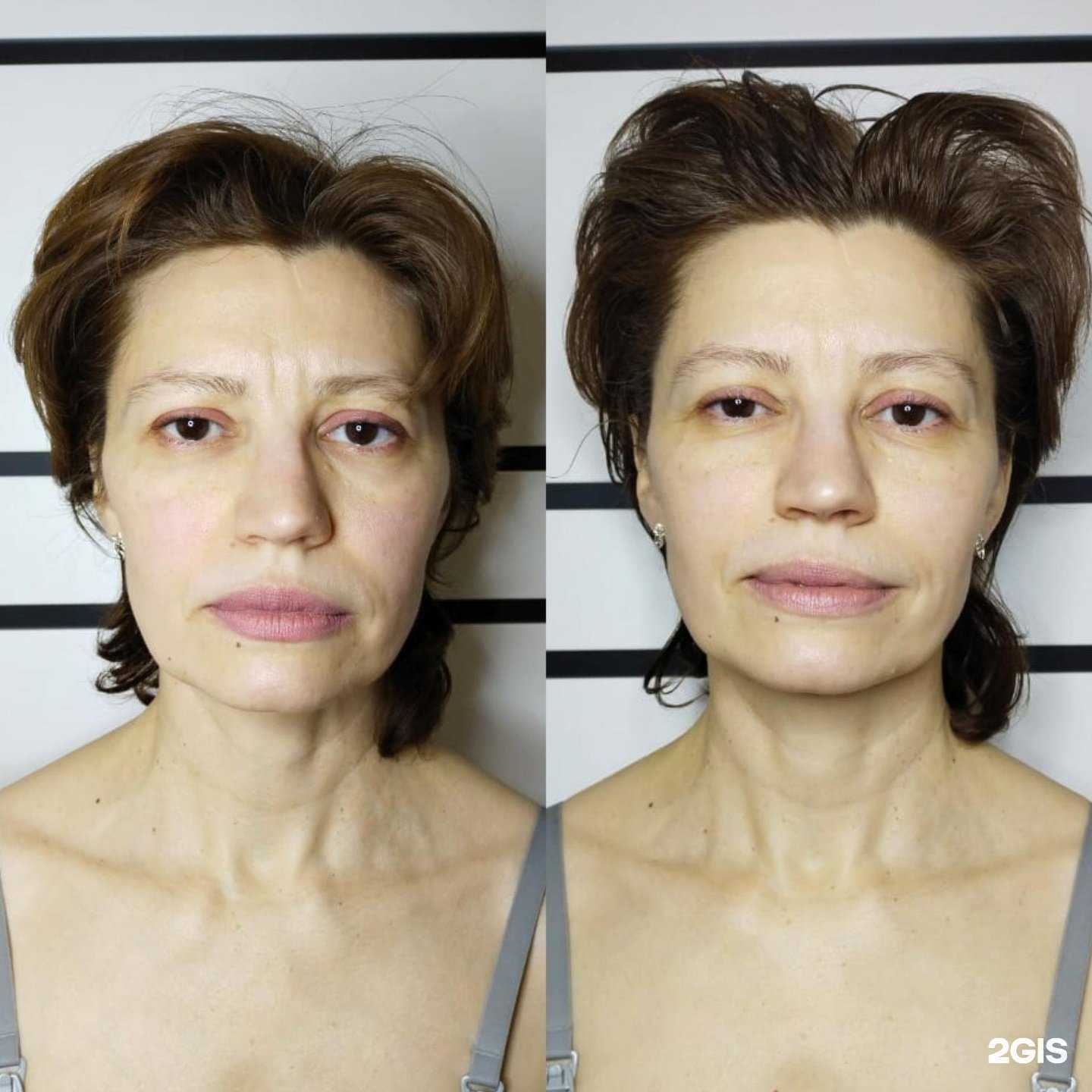 Отзывы на компанию Студия эпиляции в Воронеже c фото