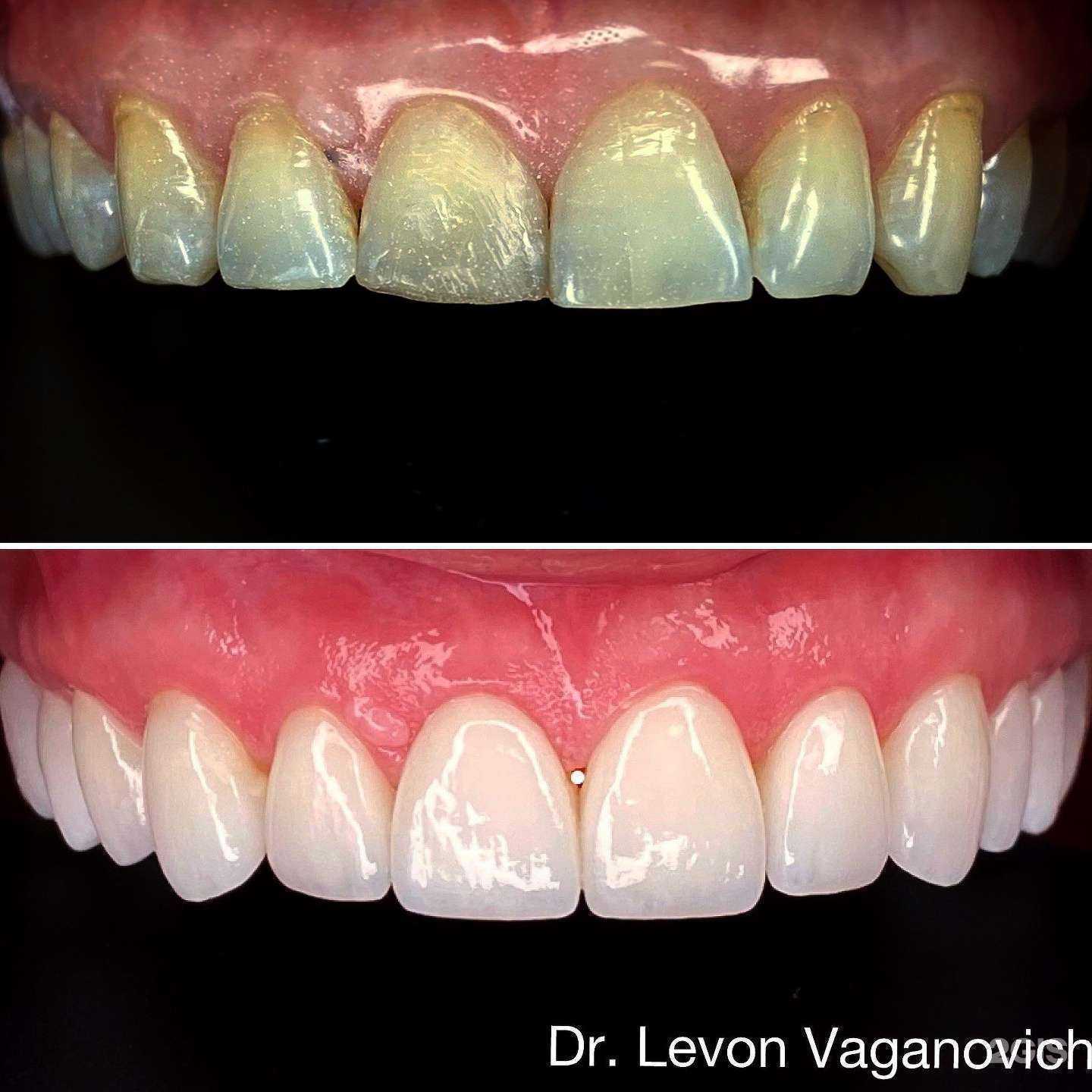 Отзывы на компанию Hollywood в г. Новороссийск c фото