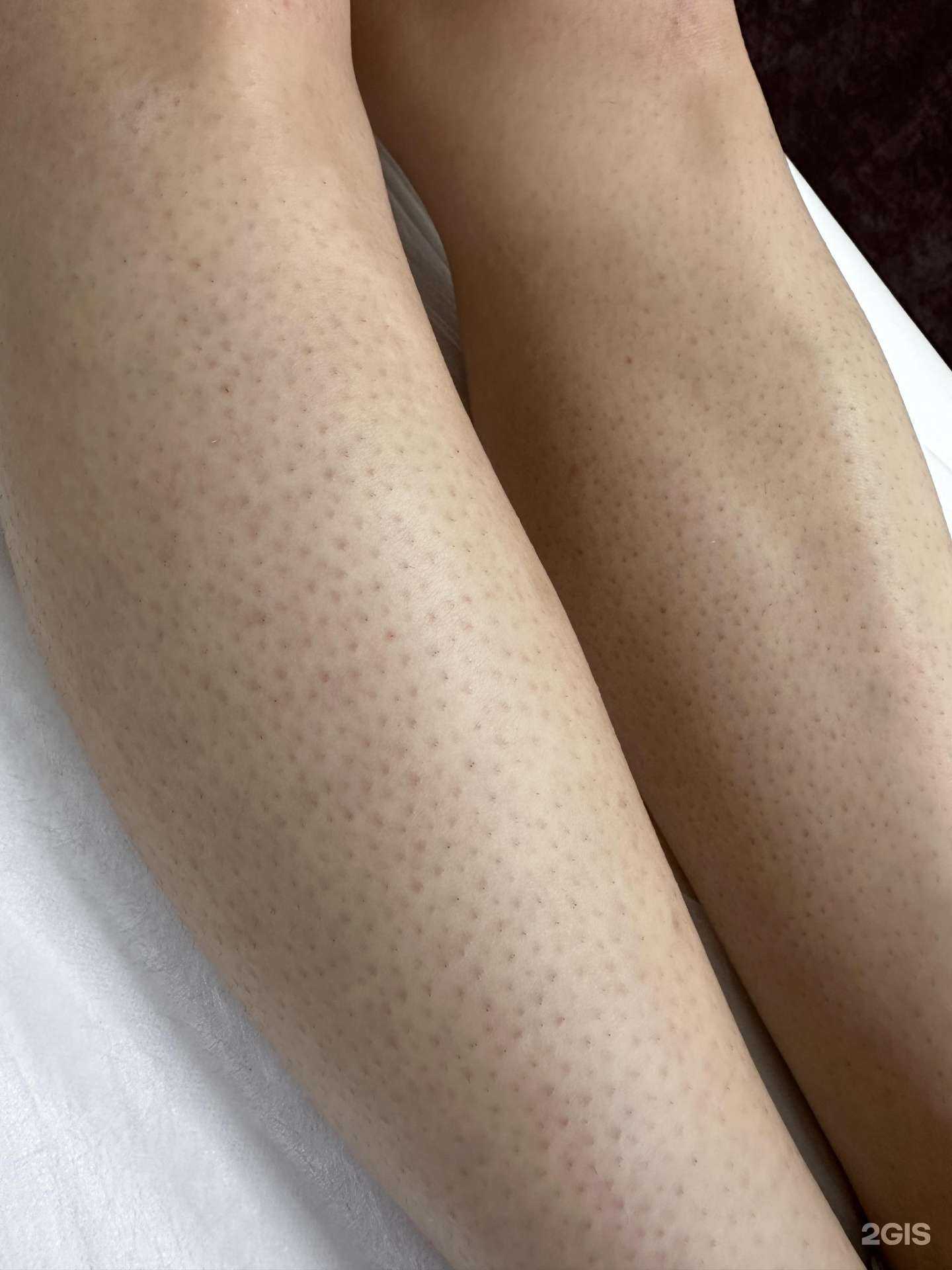 Отзывы на компанию Территория гладкости в г. Котельниково c фото