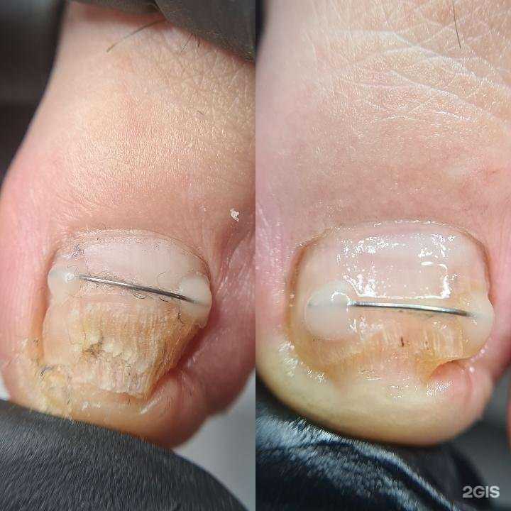 Отзывы на компанию Студия ногтевой эстетики и подологии Катерины Головачёвой в Тюмени c фото