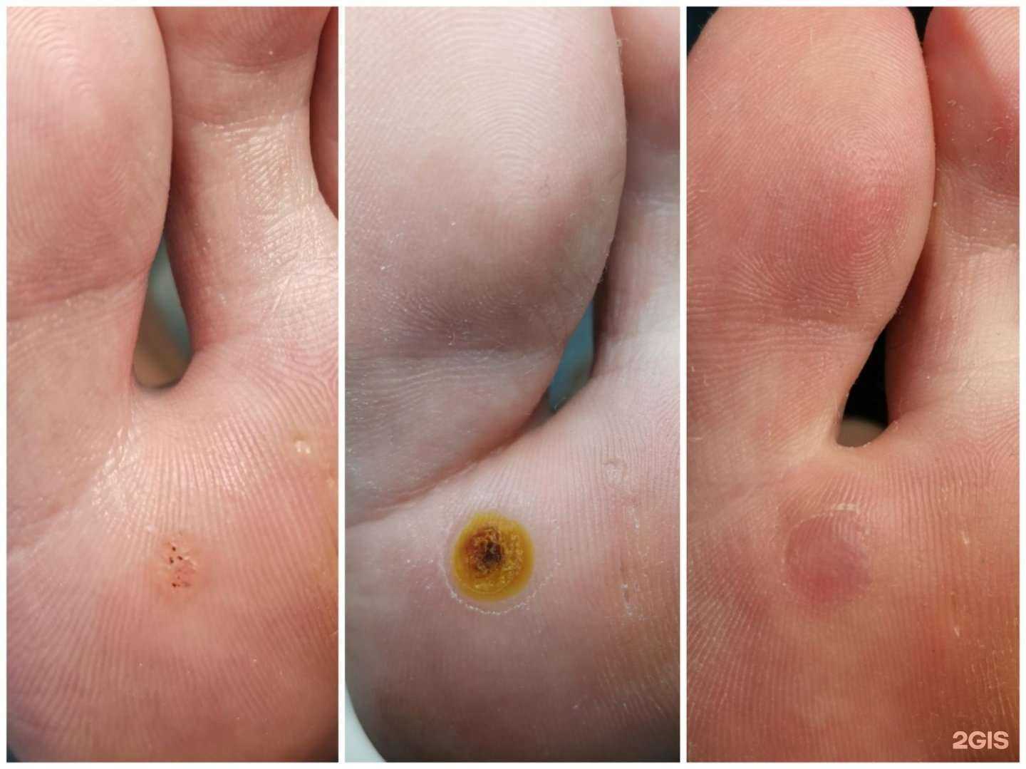 Отзывы на компанию Ваш Подолог в г. Анапа c фото