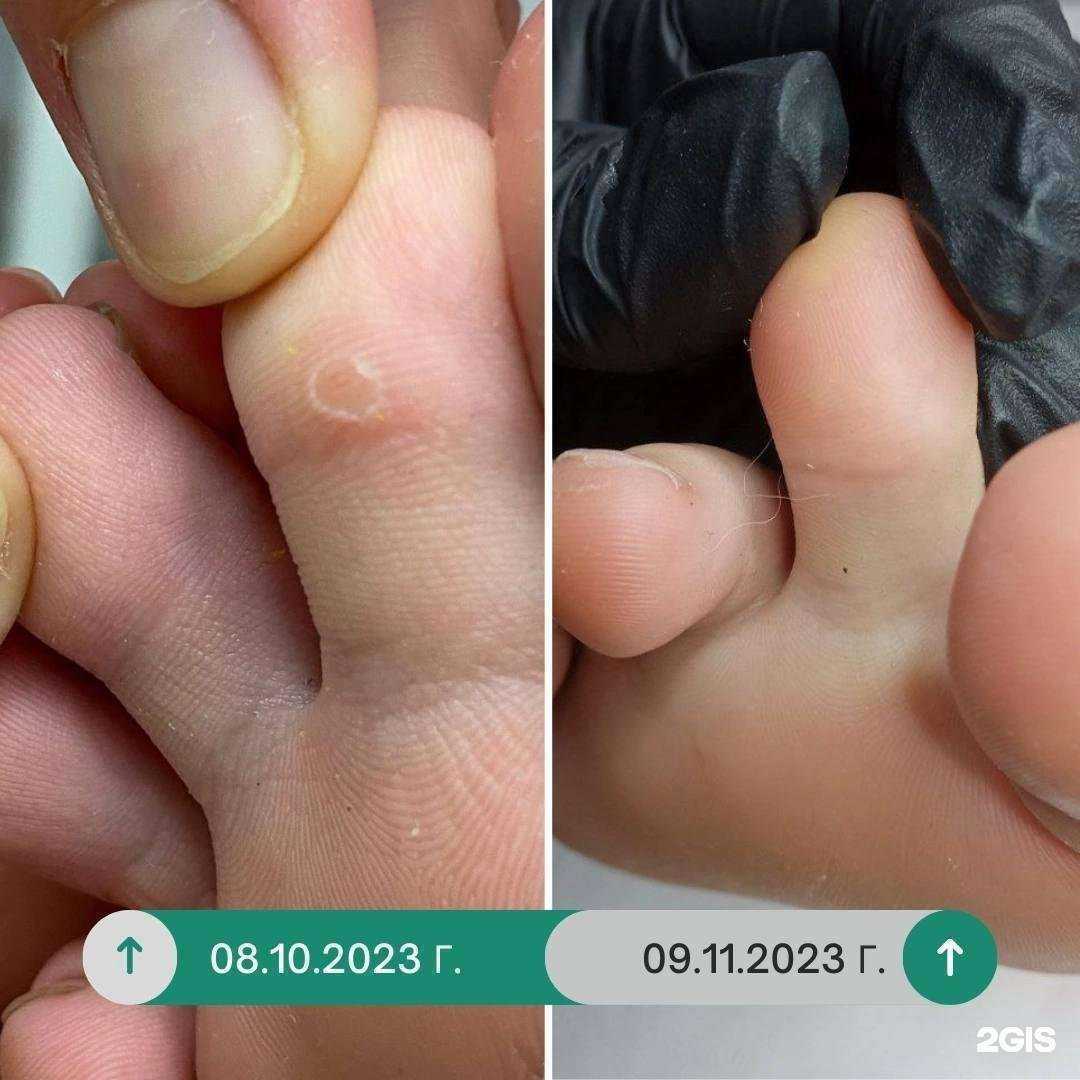 Отзывы на компанию PodoProFeet в Краснодаре c фото