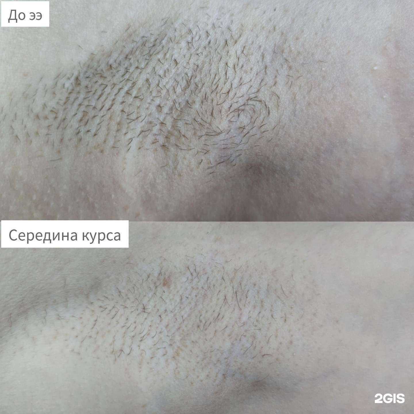 Отзывы на компанию Студия эпиляции в г. Ставрополь c фото