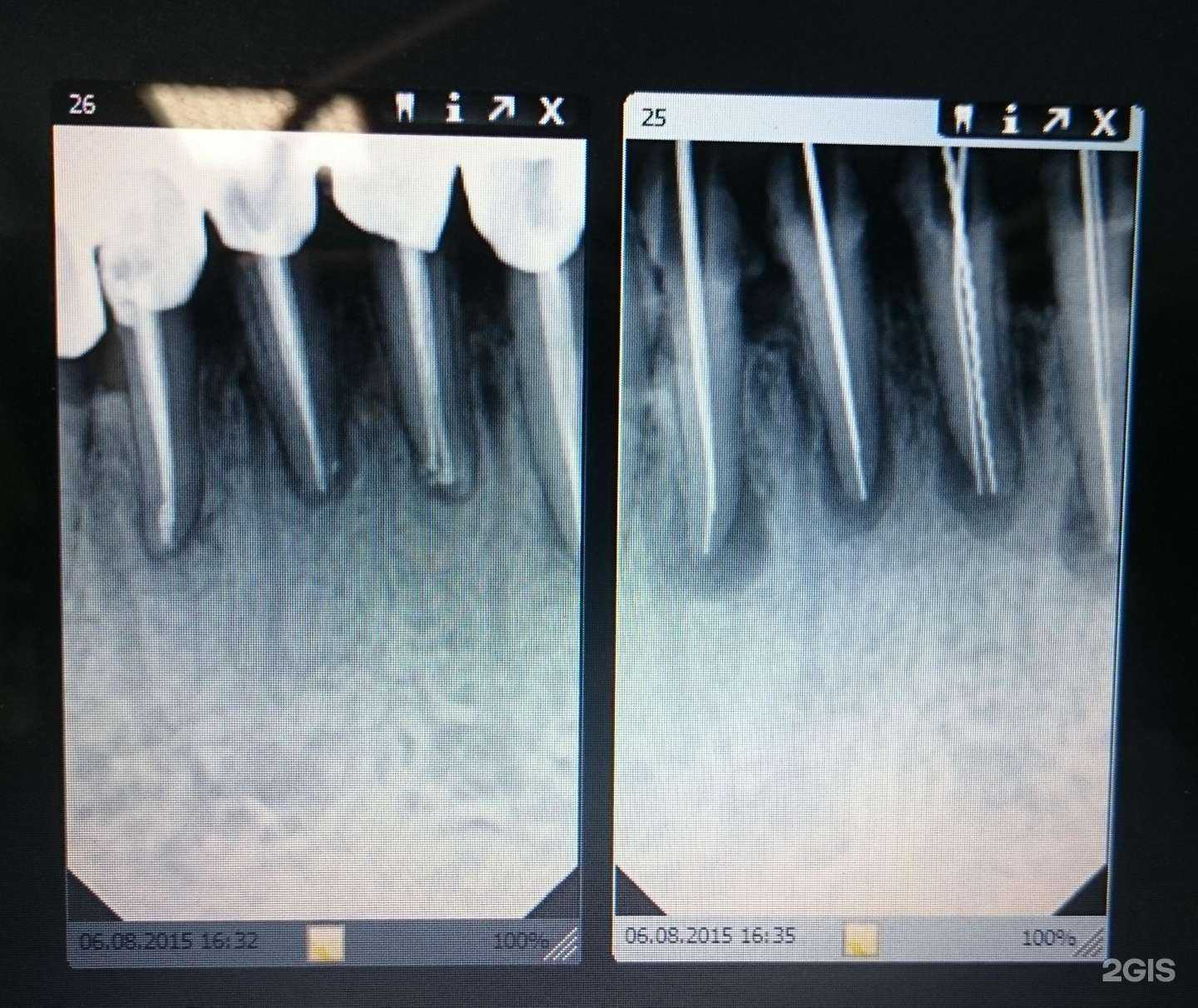 Отзывы на компанию Мотылек в Ростове-на-Дону c фото