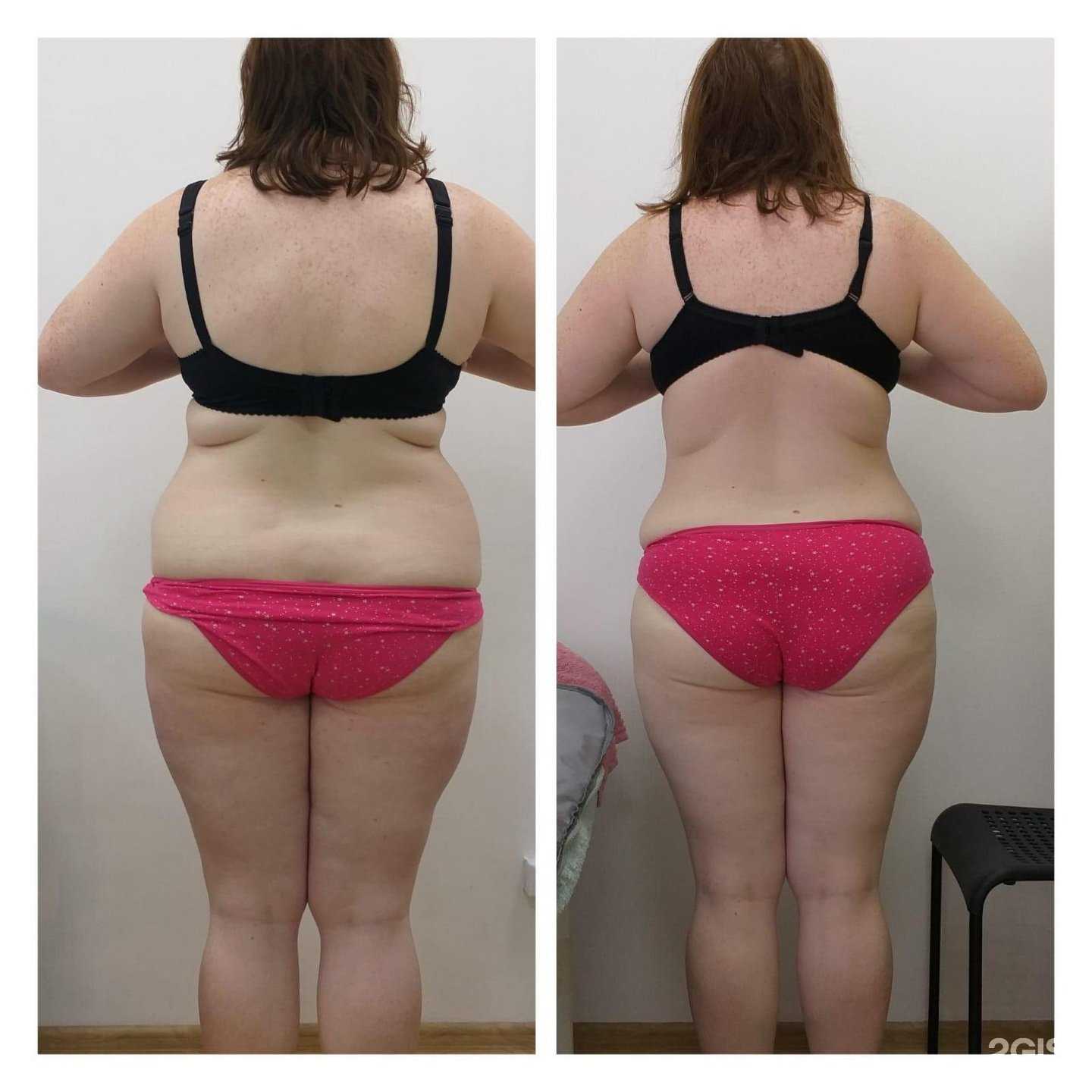 Отзывы на компанию Эстетика тела в Хабаровске c фото