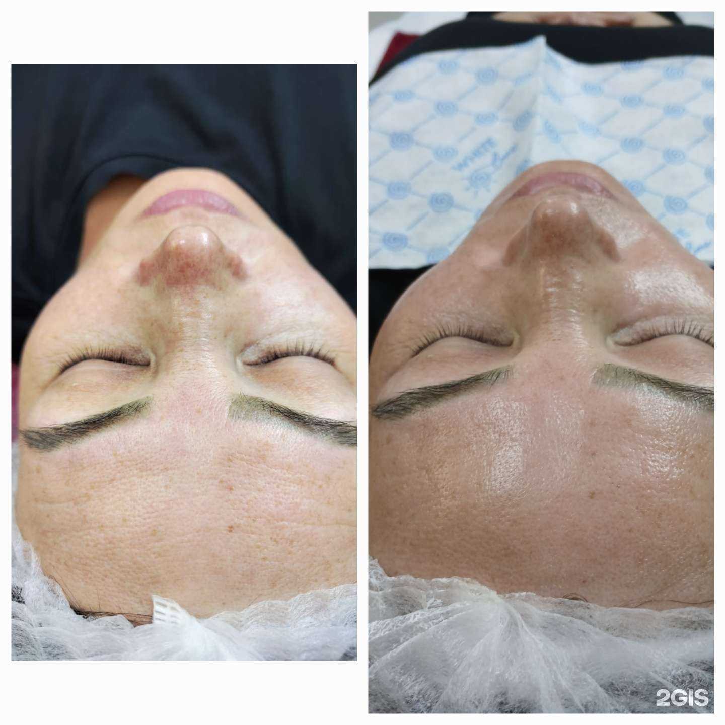 Отзывы на компанию Абахай Хыс в Абакане c фото