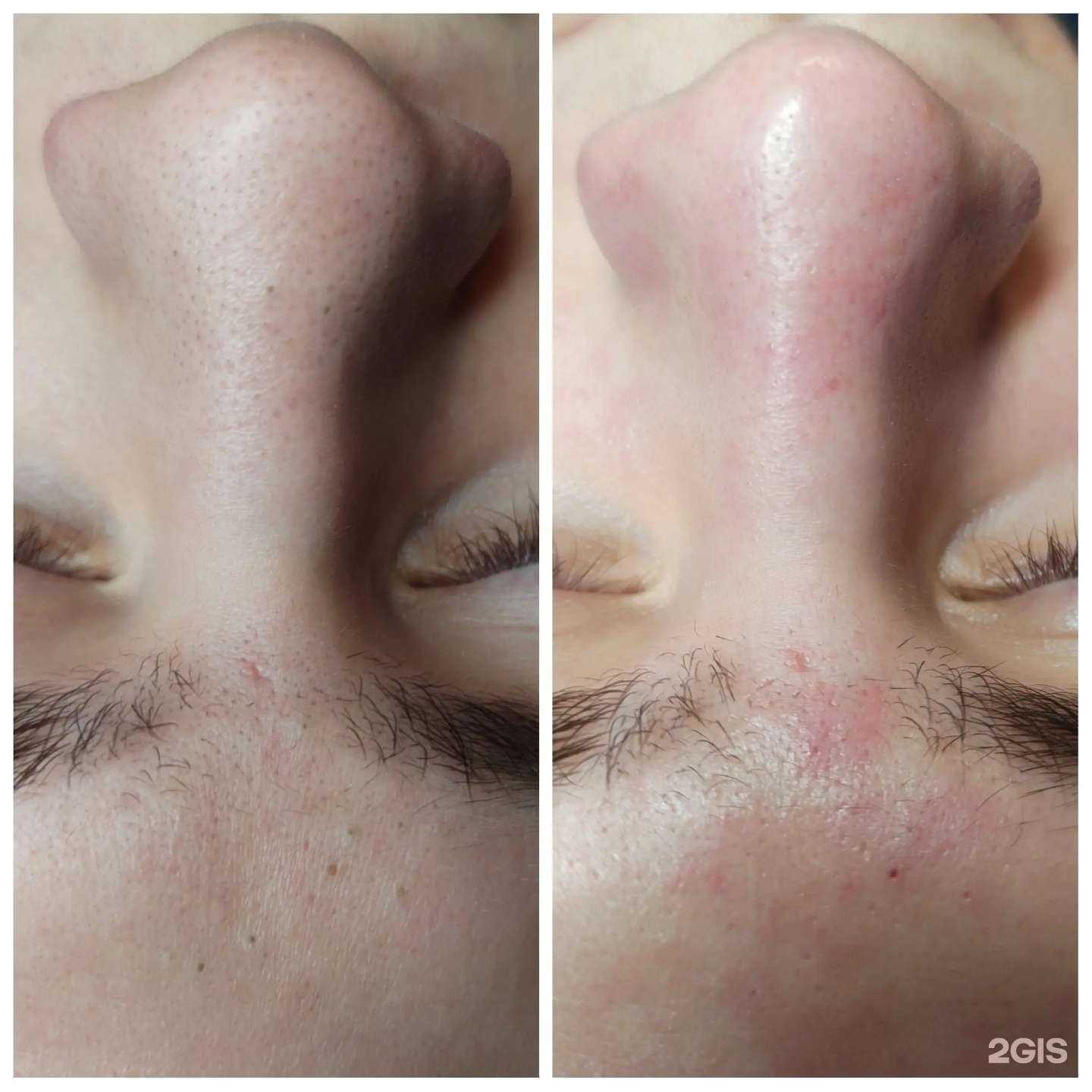 Отзывы на компанию Эстетик лайн в Нижневартовске c фото