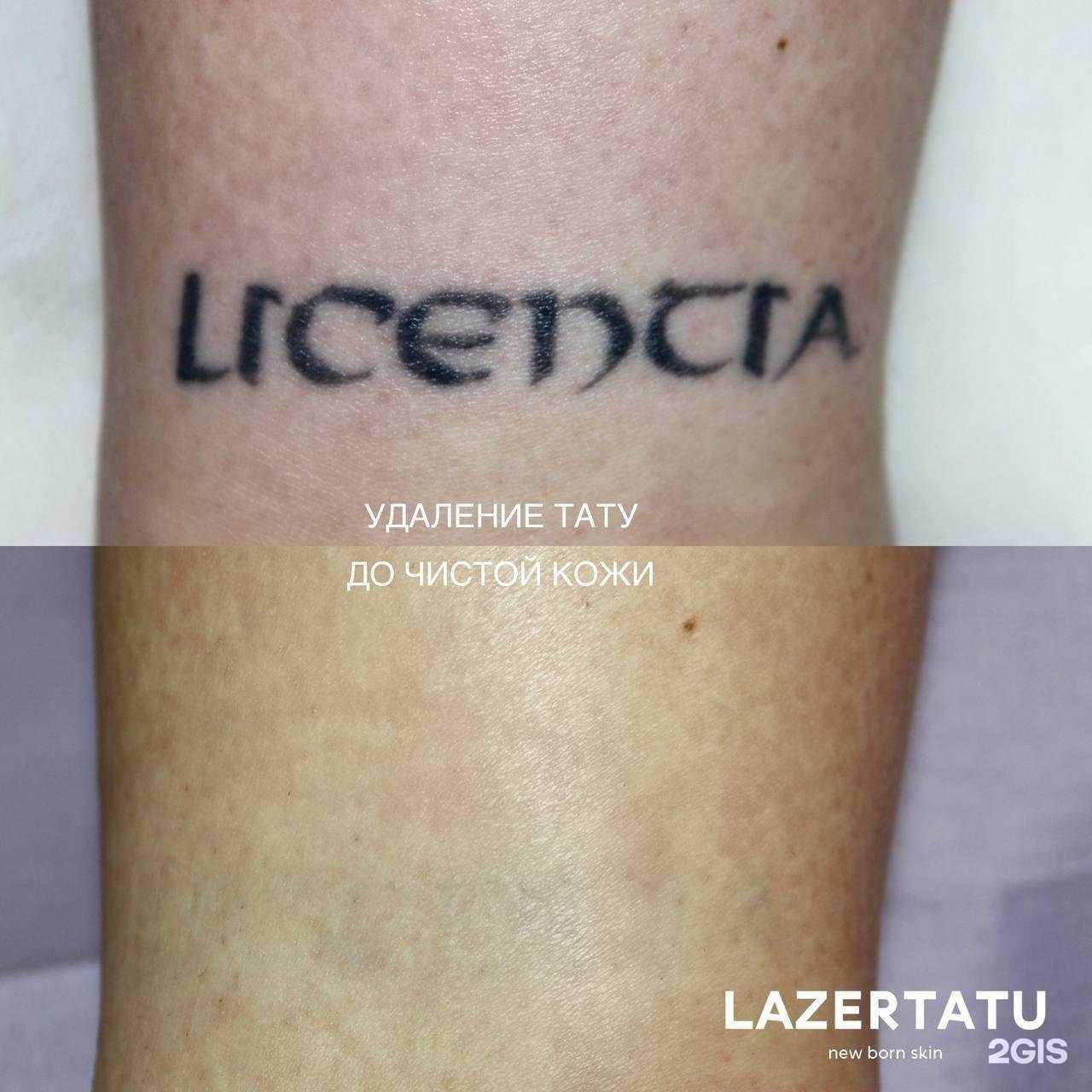 Отзывы на компанию Lazertatu в Норильске c фото