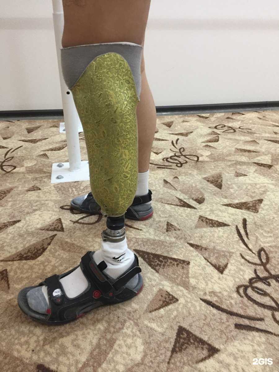 Отзывы на компанию Центр протезирования и реабилитации в Красноярске c фото