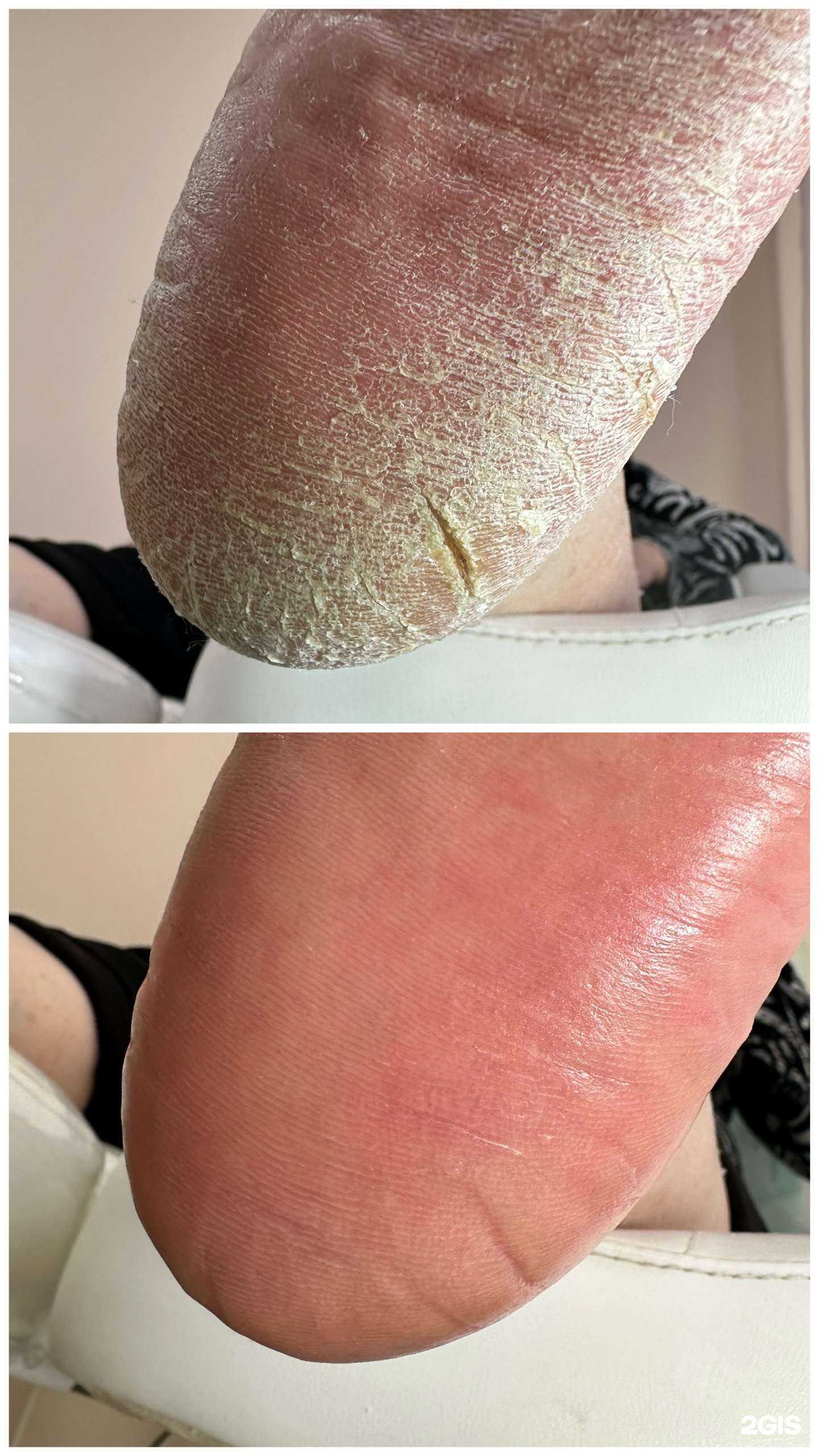 Отзывы на компанию Smart педикюр в Барнауле c фото