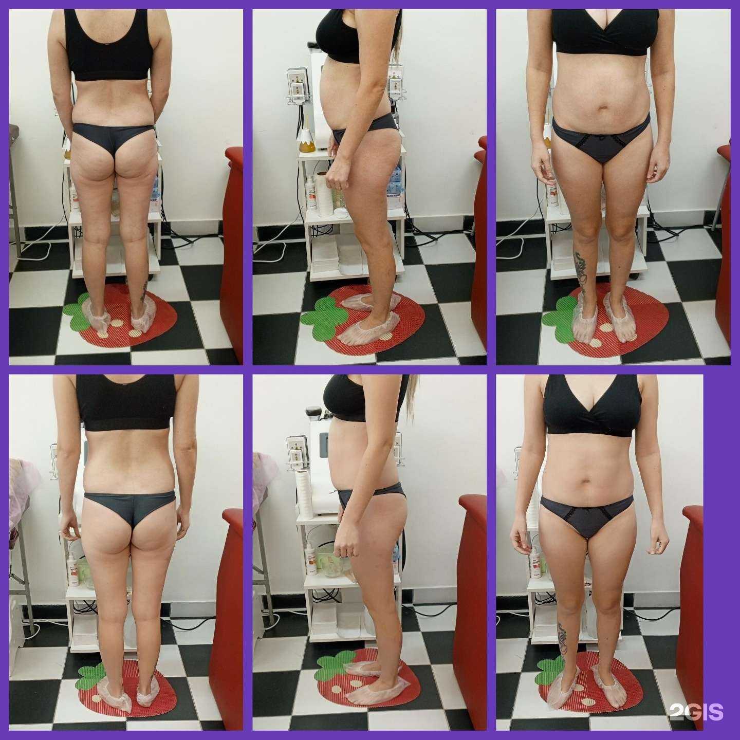 Отзывы на компанию Body_slim_by_Anetka в г. Иркутск c фото