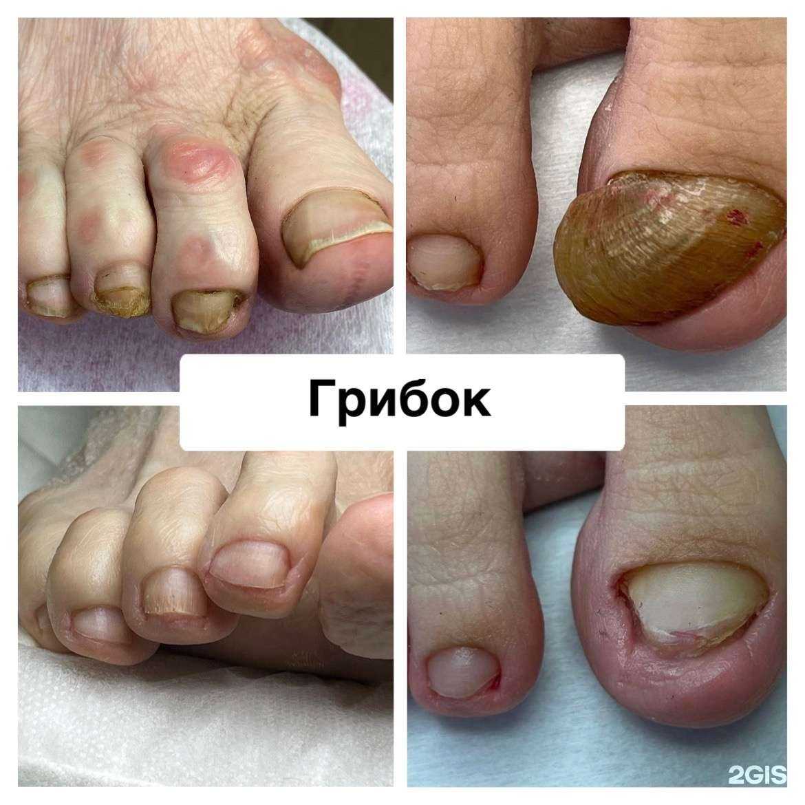 Отзывы на компанию Забота о стопах в г. Йошкар-Ола c фото