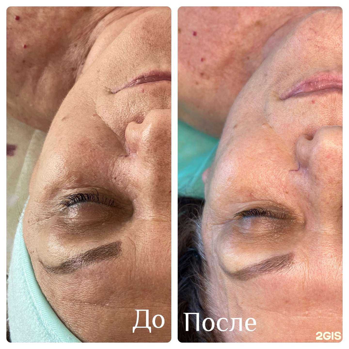 Отзывы на компанию Твой косметолог и массажист в Краснодаре c фото