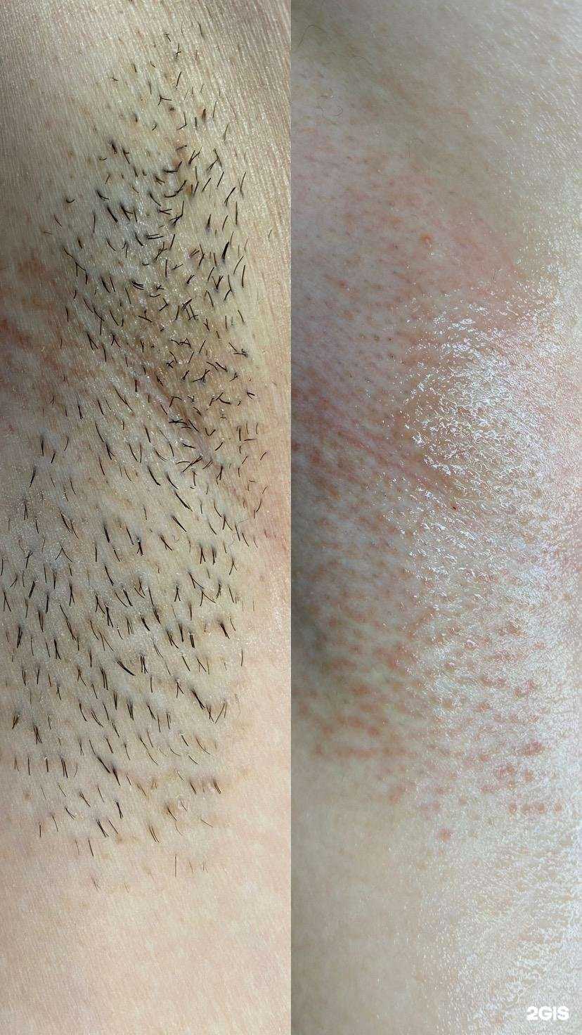Отзывы на компанию Nady_y Epil в Самаре c фото
