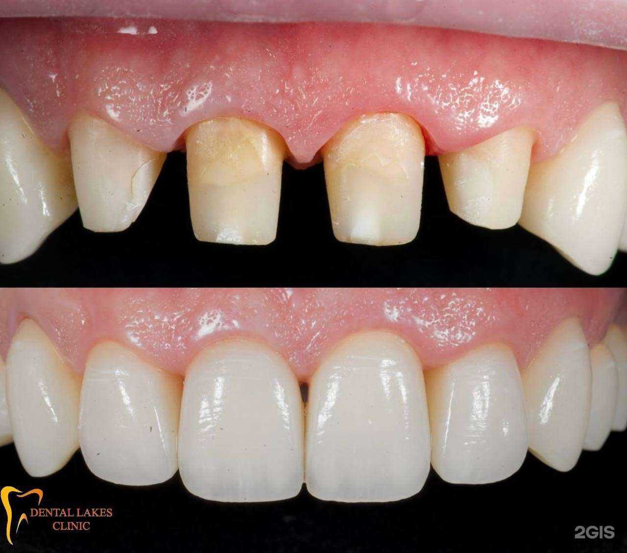 Отзывы на компанию Dental Lakes в Норильске c фото