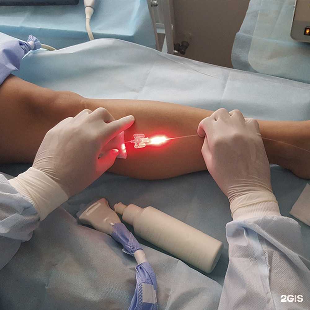 Отзывы на компанию Варикоза нет в Вологде c фото