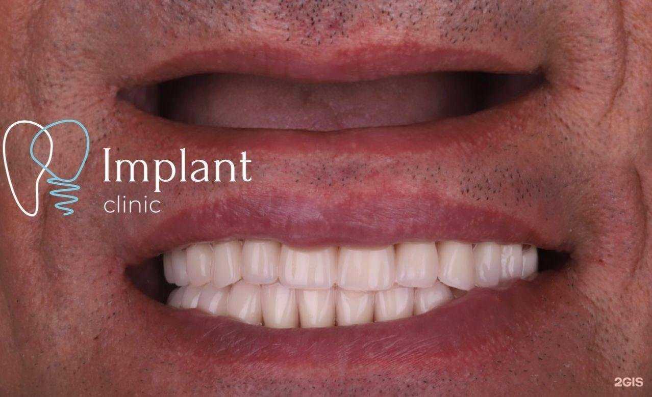 Отзывы на компанию Implant Clinic в Краснодаре c фото