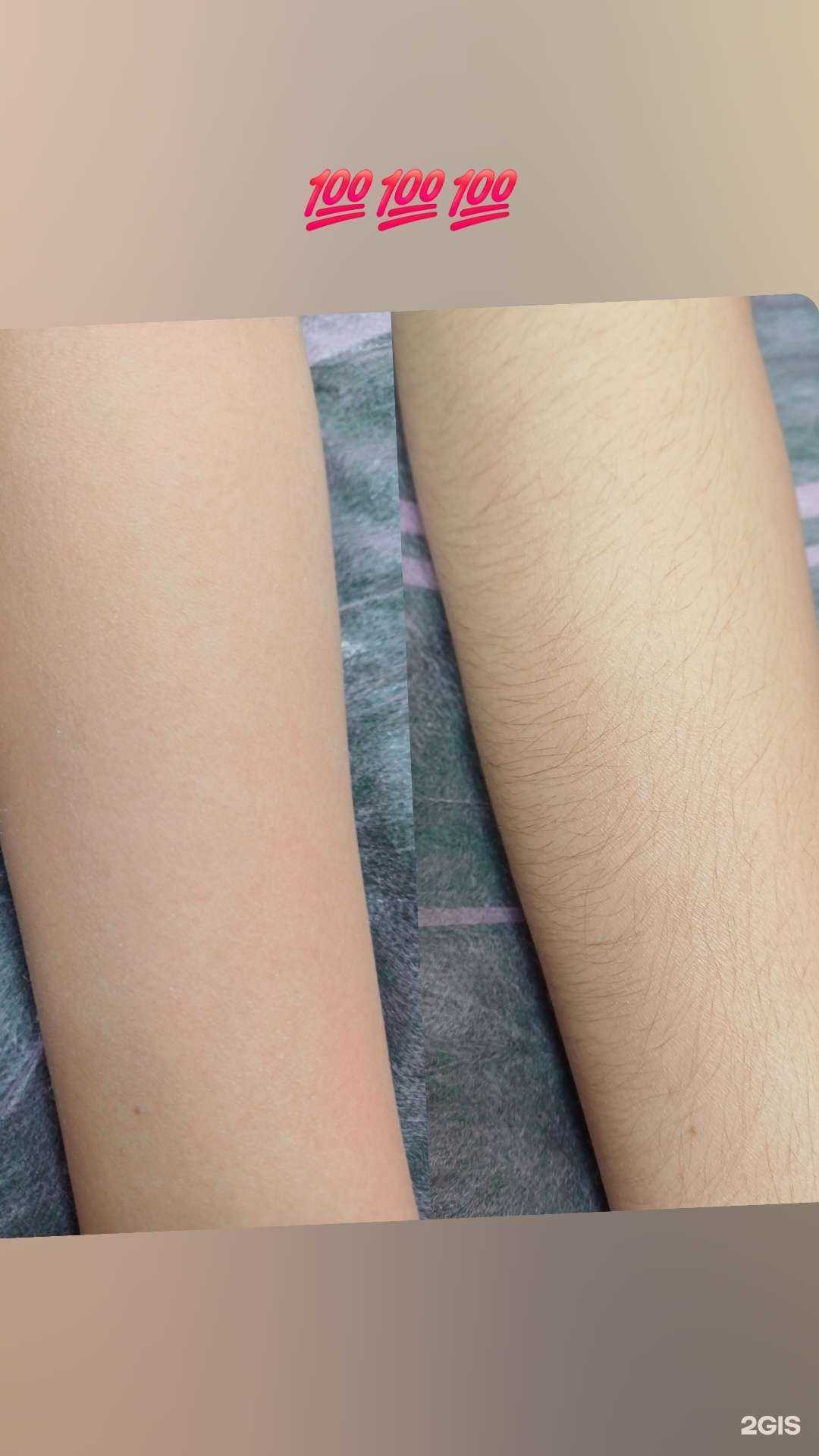 Отзывы на компанию Студия эпиляции в Омске c фото