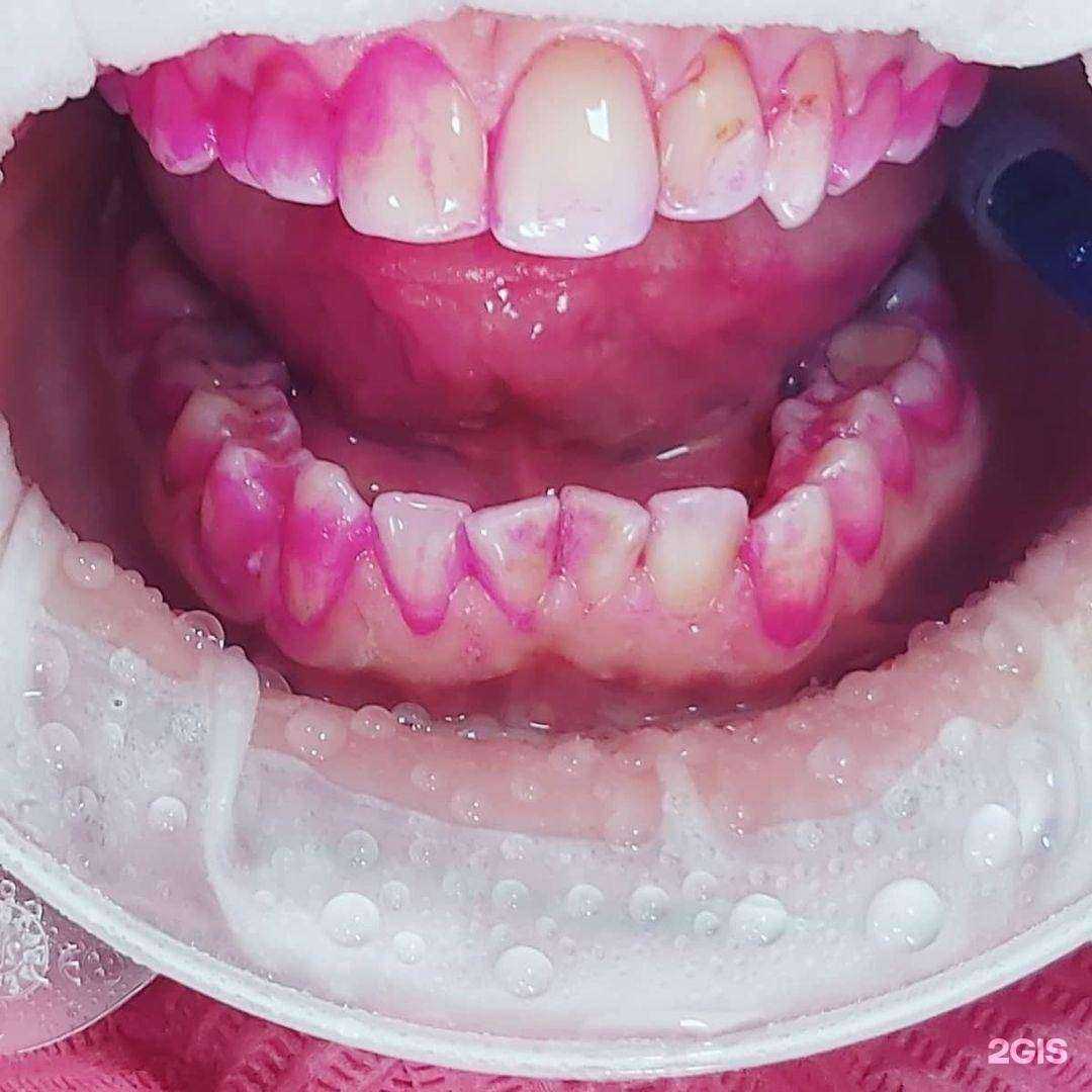 Отзывы на компанию Эстелайф в Владивостоке c фото