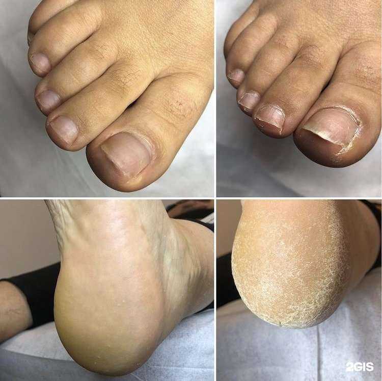 Отзывы на компанию Подологический центр Александры Сидоренко в Хабаровске c фото