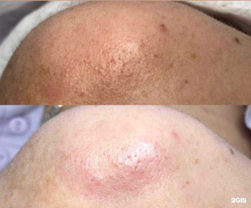 Отзывы на компанию Elap в Альметьевске c фото