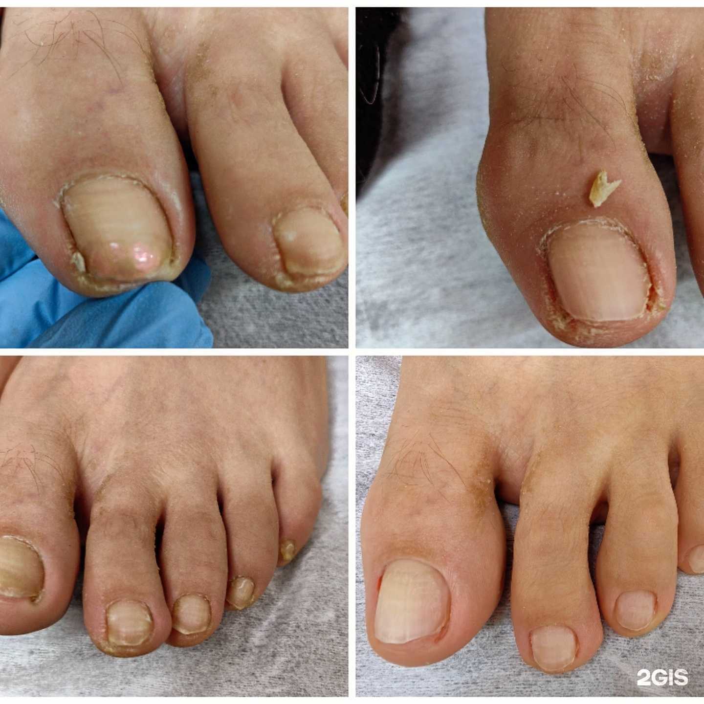 Отзывы на компанию Кабинет подолога в Новокузнецке c фото