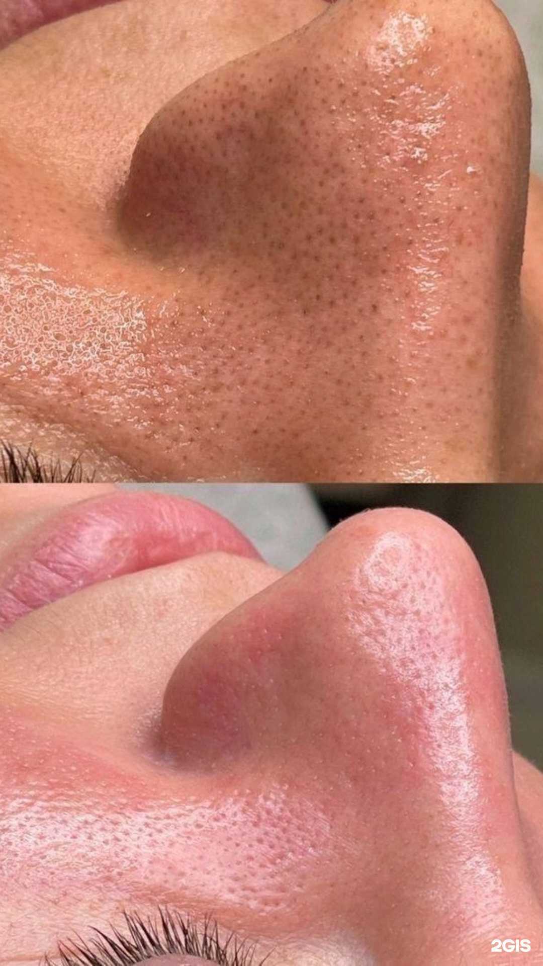 Отзывы на компанию Brusnikа в г. Нижневартовск c фото