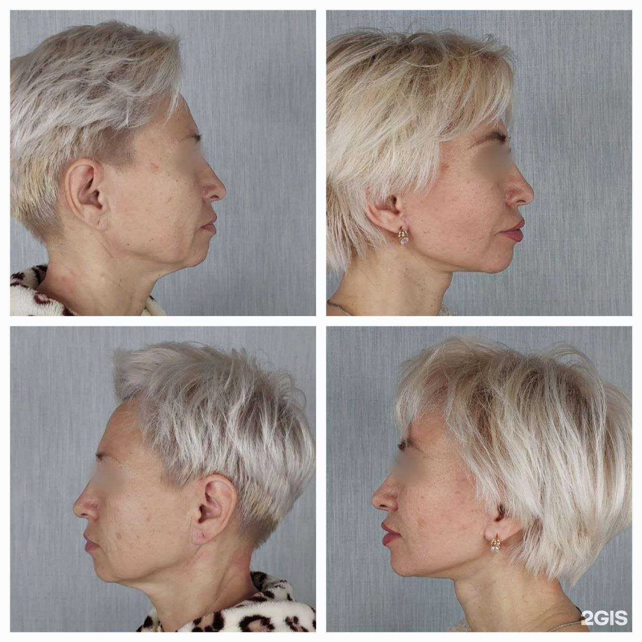 Отзывы на компанию Космо Пластик в Твери c фото