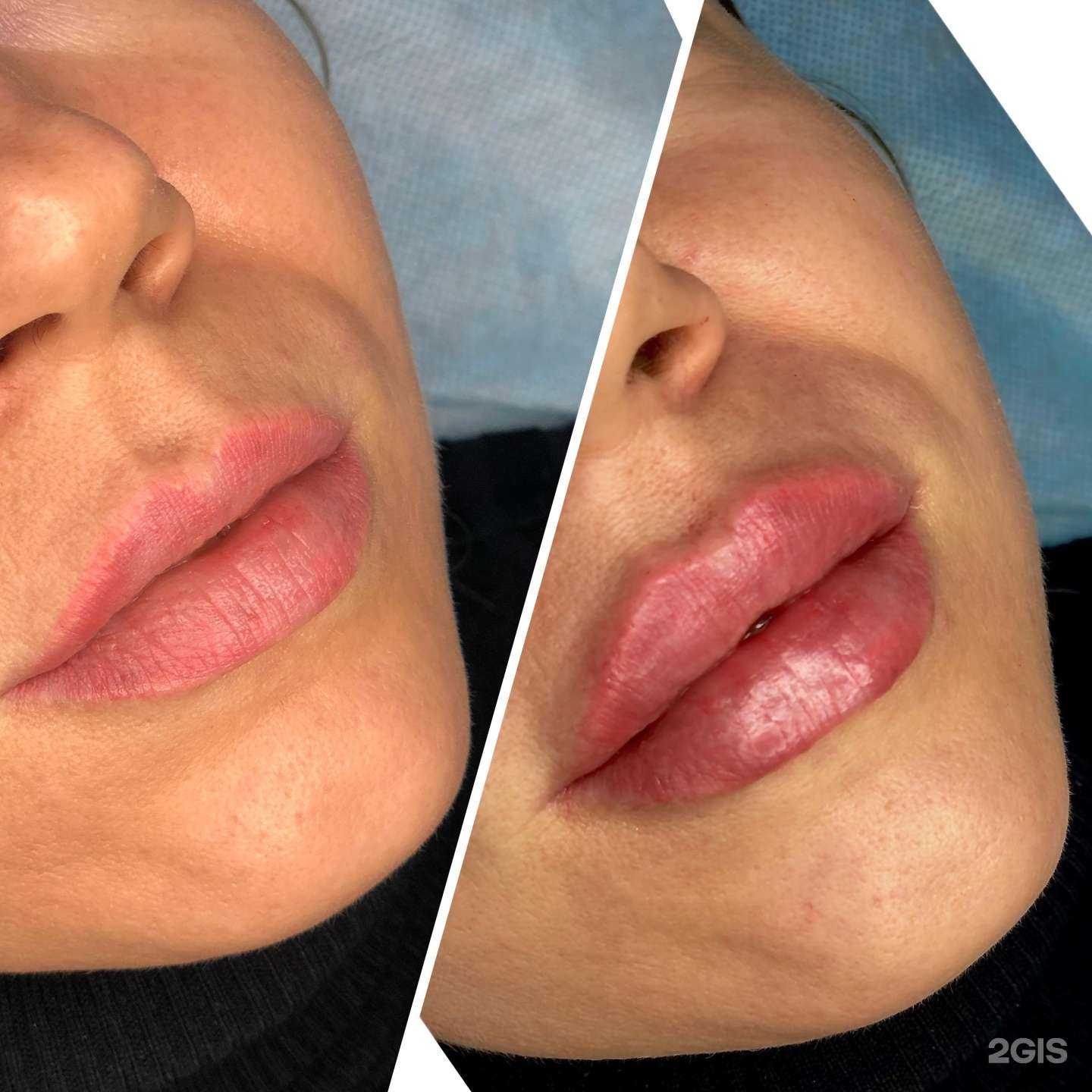 Отзывы на компанию Косметологический кабинет в Бердске c фото