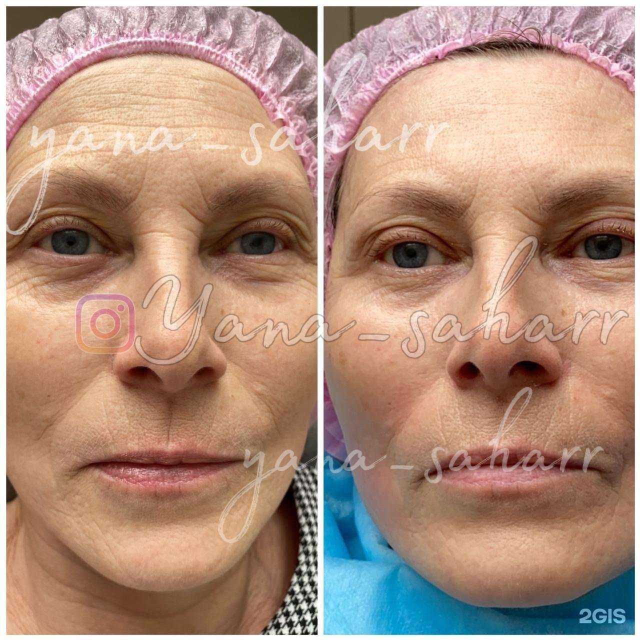 Отзывы на компанию Yana_saharr в г. Новокузнецк c фото