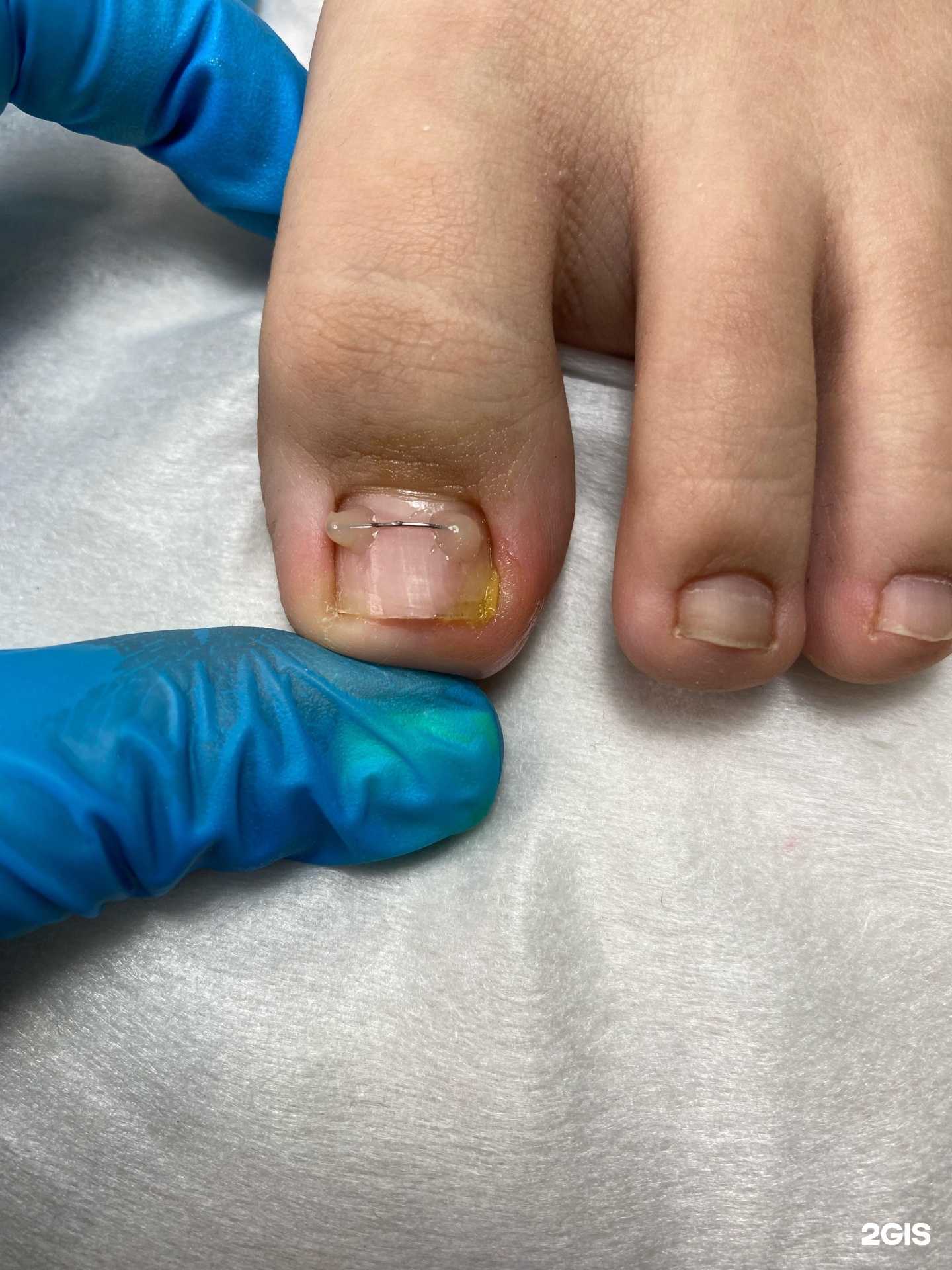 Отзывы на компанию Nails Yana в г. Якутск c фото