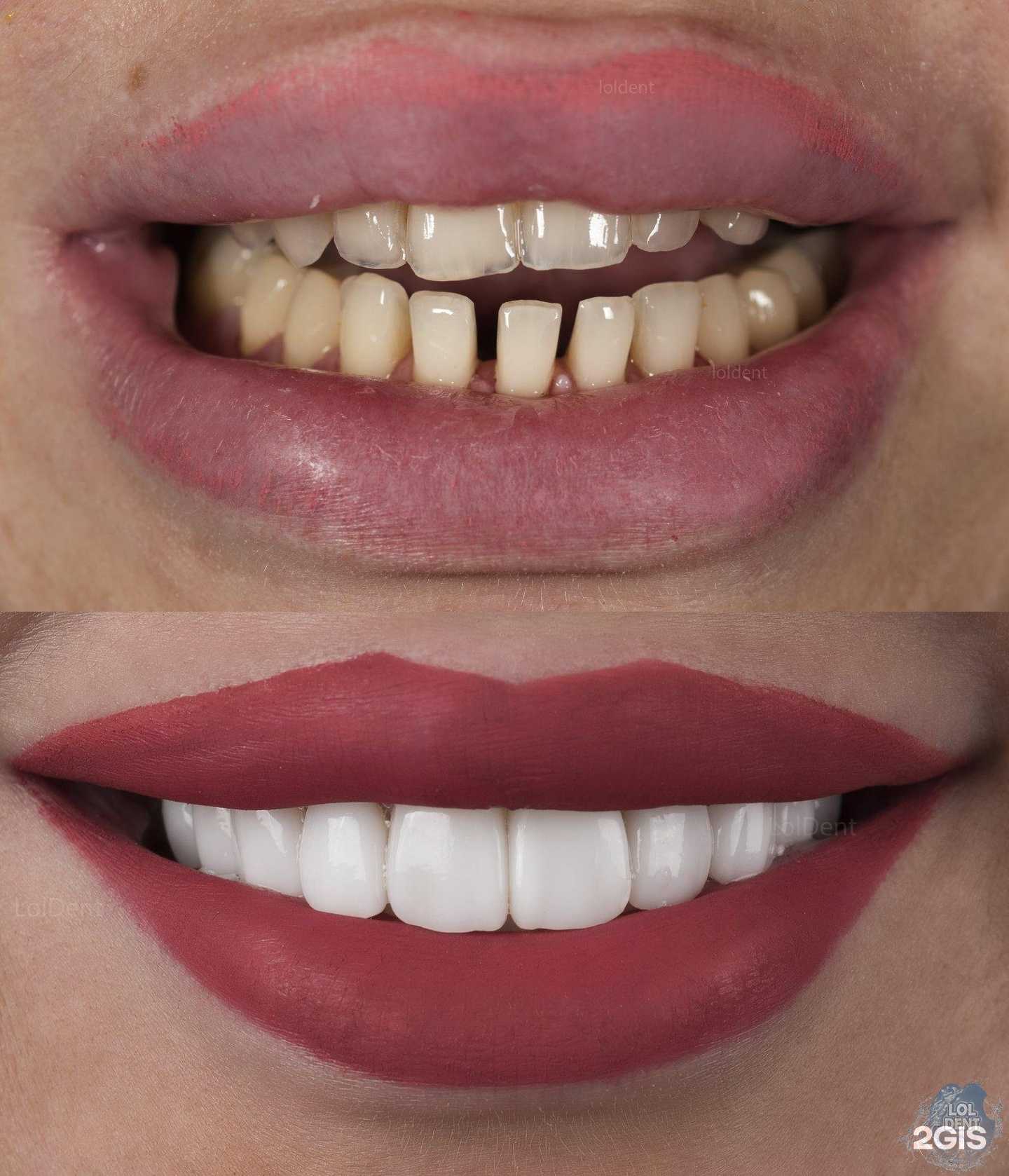 Отзывы на компанию LolDent в г. Ростов-на-Дону c фото