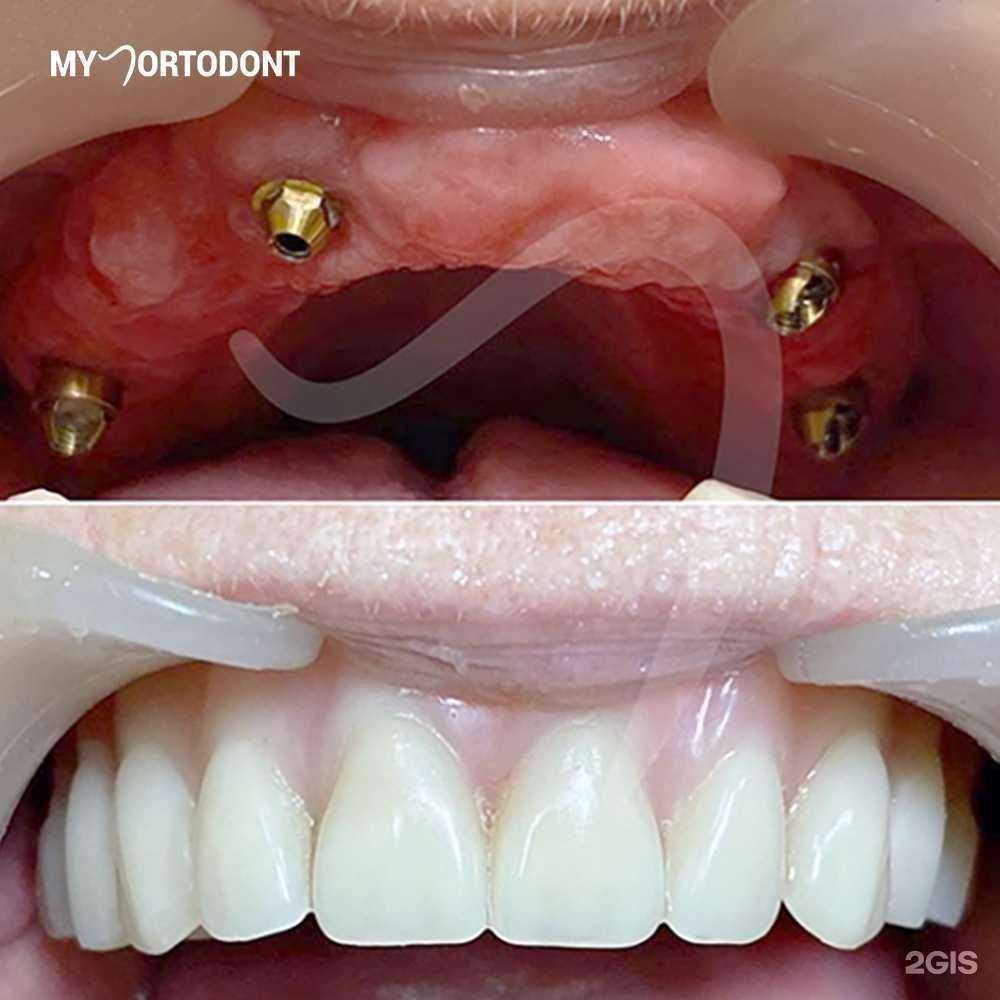 Отзывы на компанию My Ortodont в Буйнакске c фото