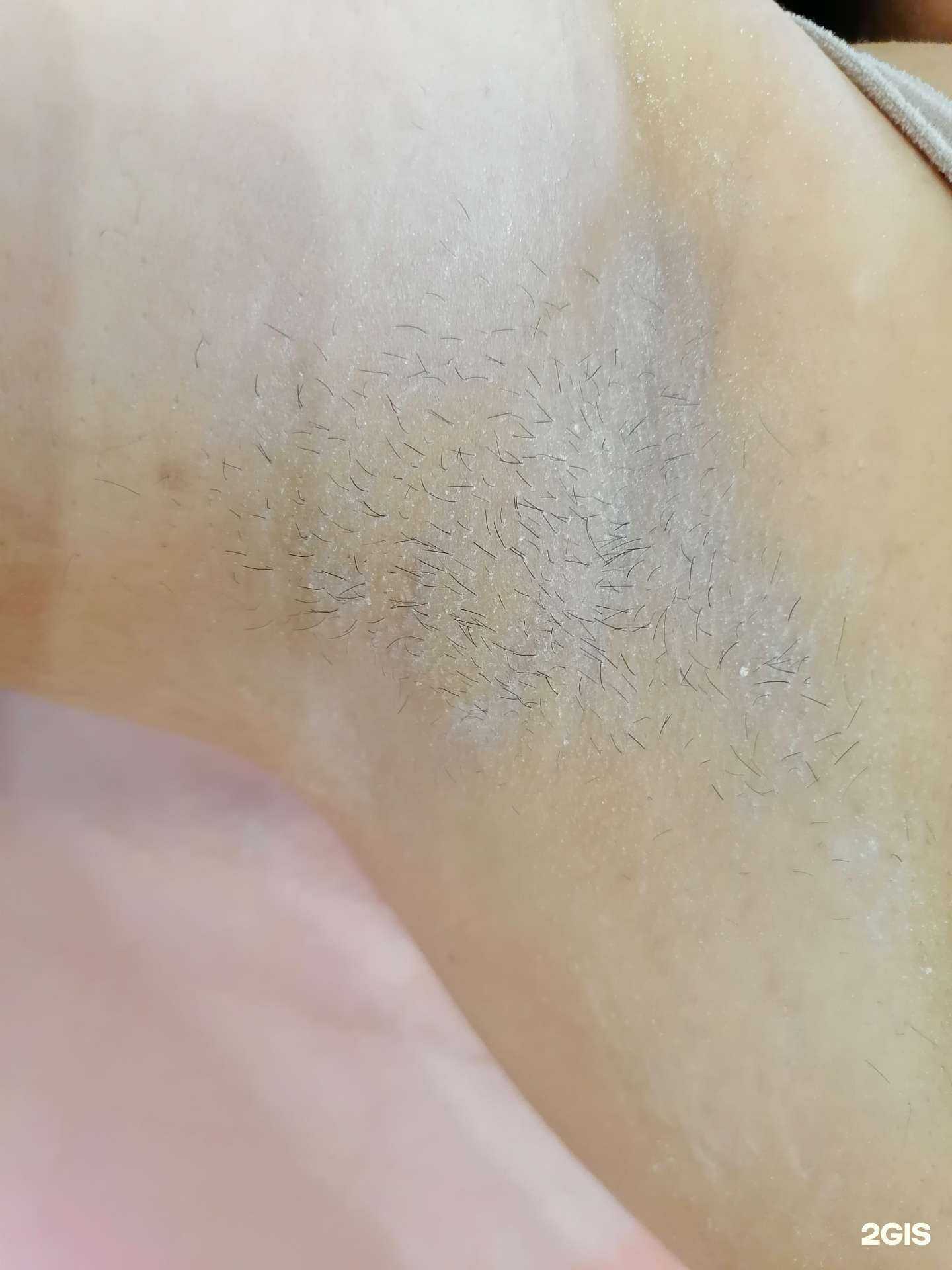 Отзывы на компанию Кабинет эпиляции в г. Калининград c фото