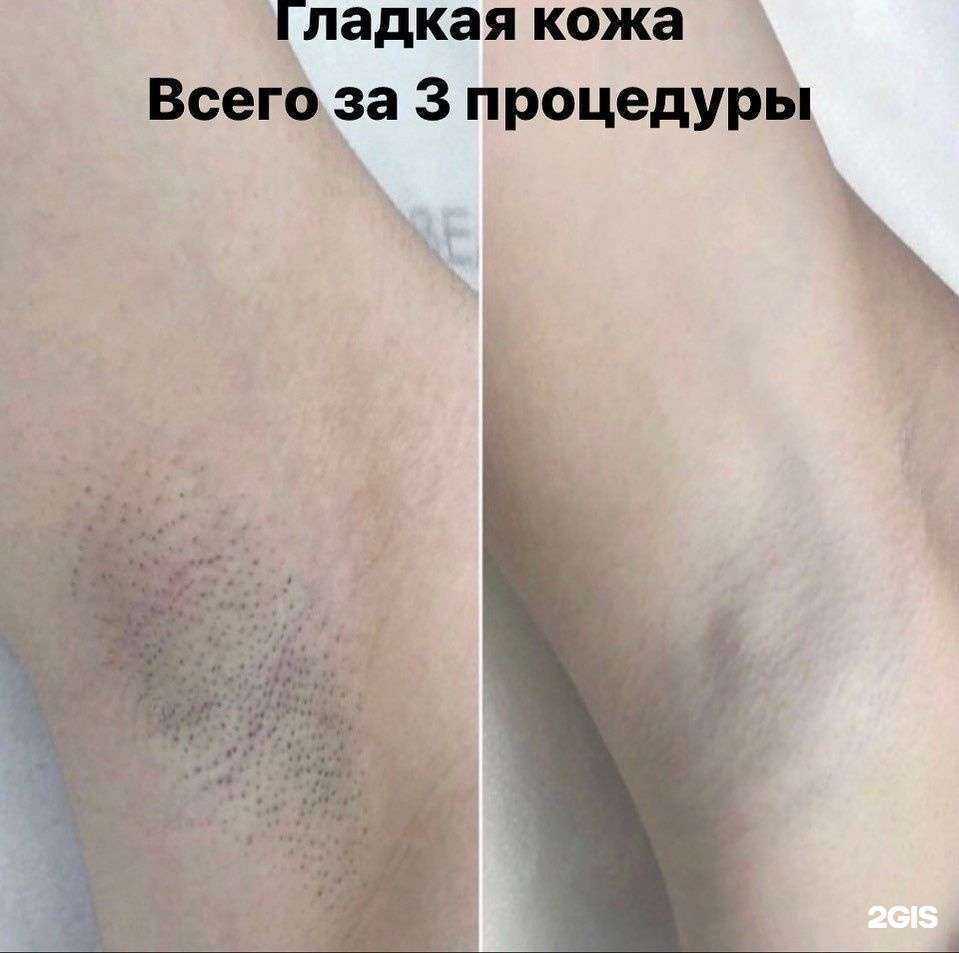 Отзывы на компанию Кабинет эпиляции и коррекции фигуры в г. Нижнекамск c фото