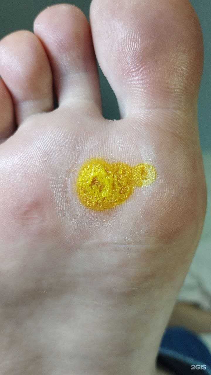 Отзывы на компанию Подологический центр в г. Ярославль c фото