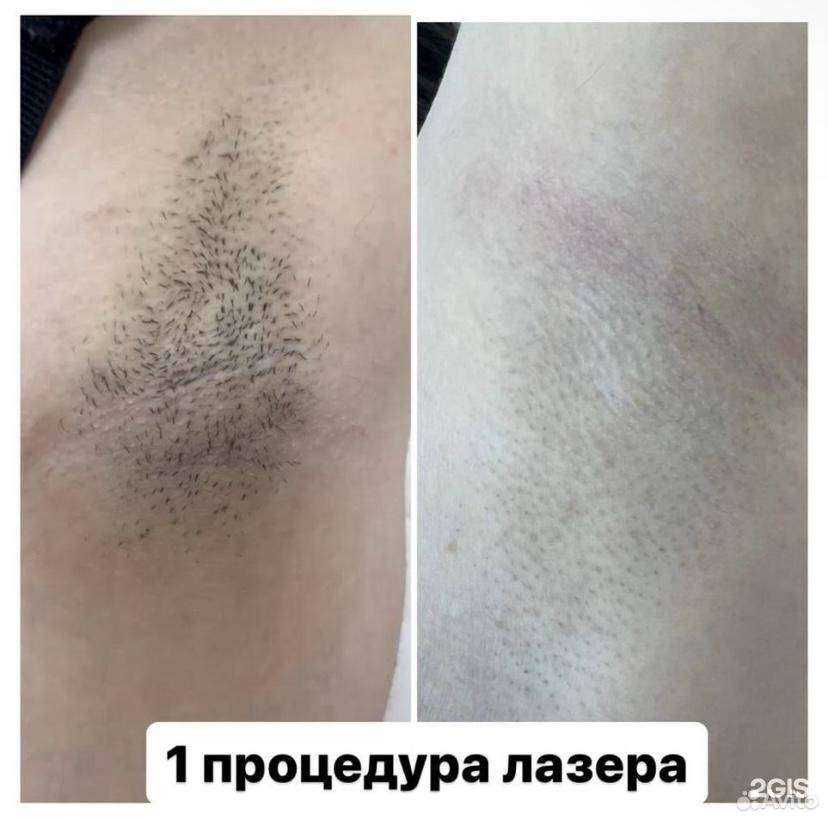 Отзывы на компанию Beauty Laser в г. Астрахань c фото